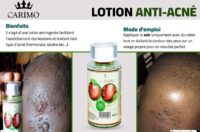 Lotion anti acné