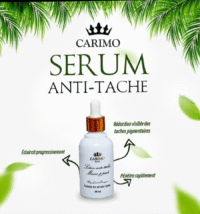 Lotion anti-tâches éclat ✨Nouvelle formule✨