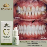 Gouttes sourire Carimo
