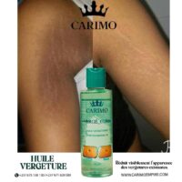 Huile Vergecure✨nouvelle formule✨